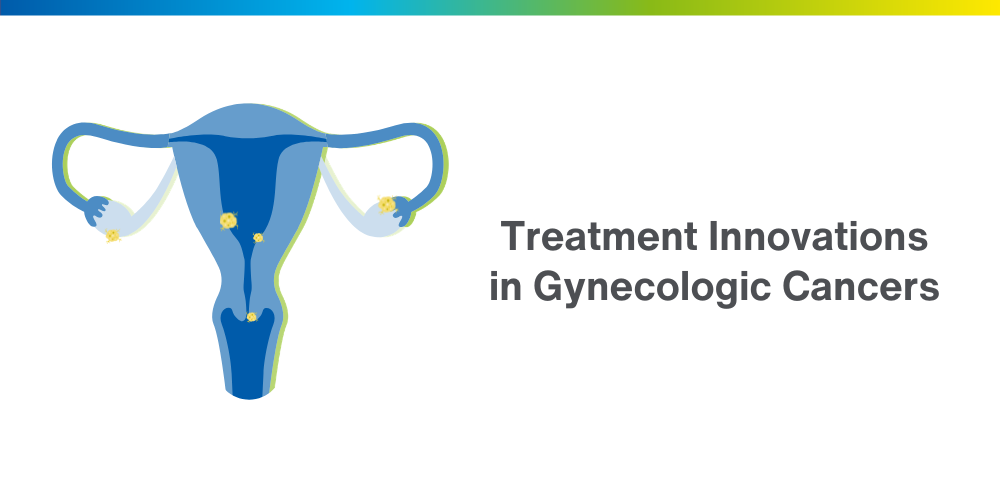 Illustration of the female reproductive system with highlighted areas indicating cancer sites, alongside the text ‘Treatment Innovations in Gynecologic Cancers