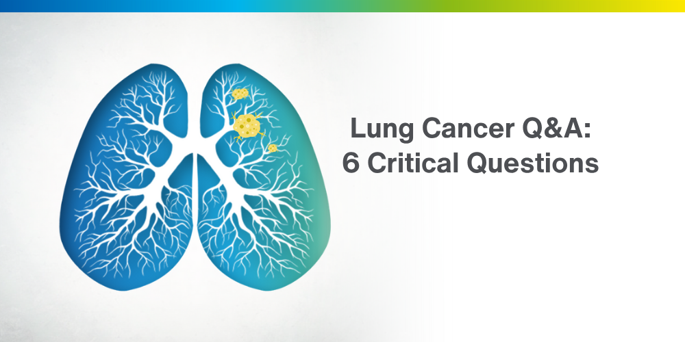 Lung Cancer Can Affect Anyone: Understanding the Risks, Symptoms and Early Detection